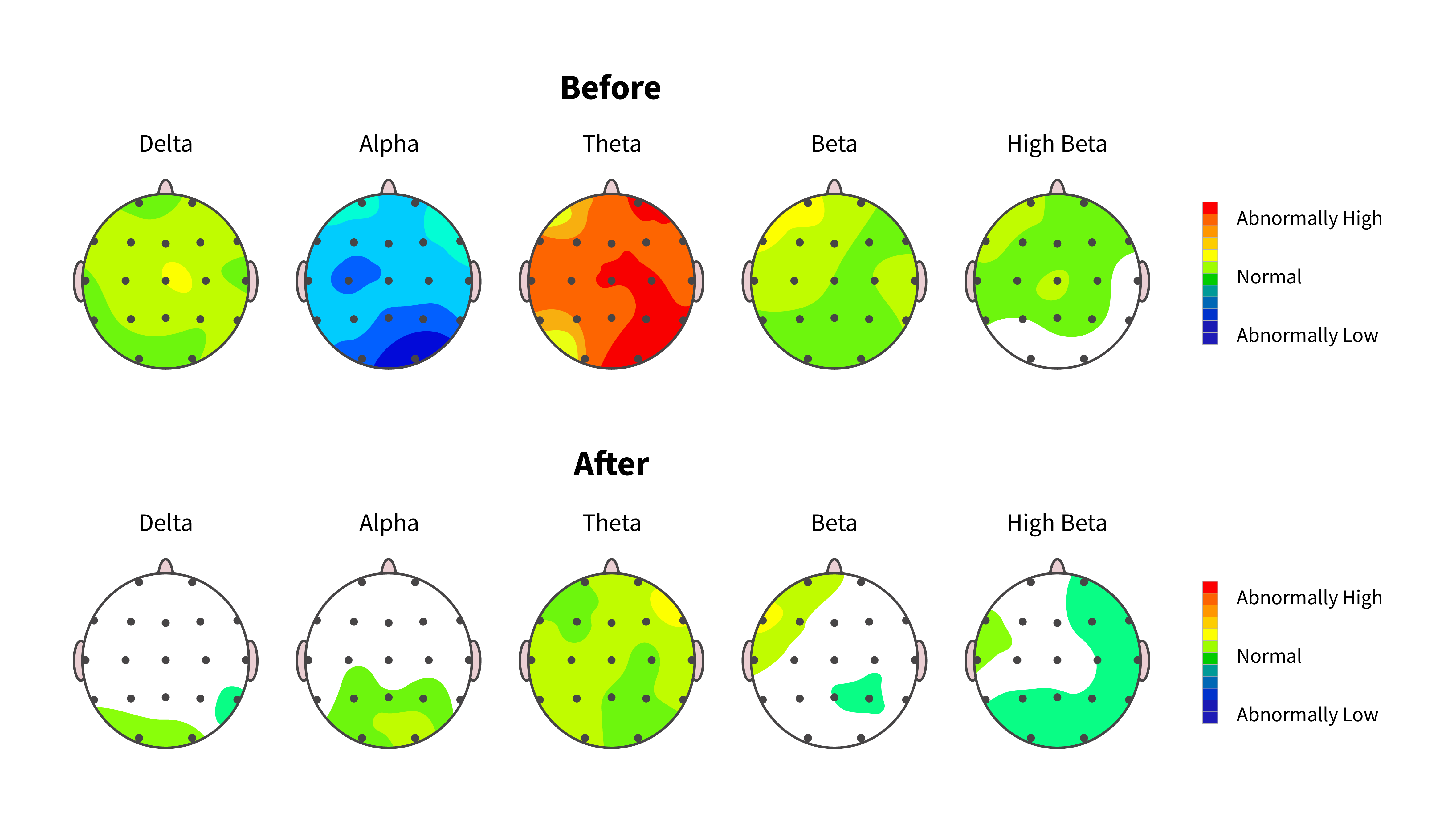Brain Map Comparison Brain Map Comparison